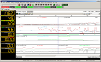 Analyzing log